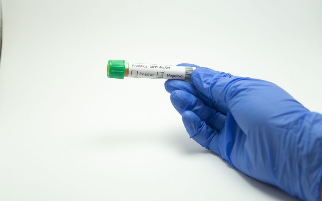 Coronavirus : Ecolo demande un dépistage de l’ensemble de la population